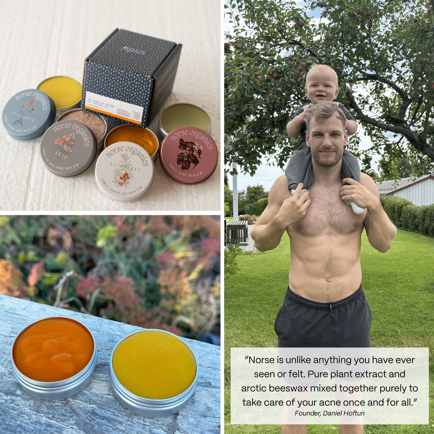 Pimple Stopper Day Balm