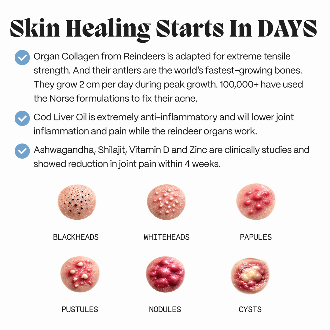 Complete Gut Repair & Hormonal Balance System for Male Acne