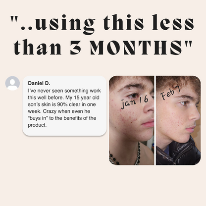 Complete Gut Repair & Hormonal Balance System for Male Acne