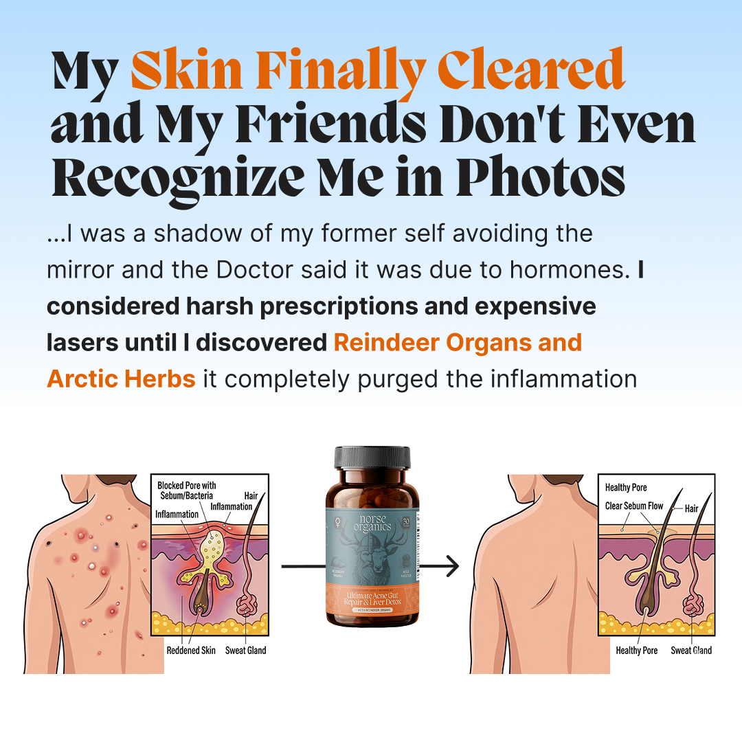 Complete Gut Repair & Hormonal Balance System for Male Acne