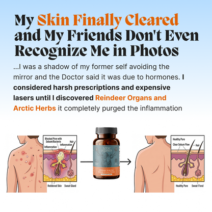 Complete Gut Repair & Hormonal Balance System for Male Acne